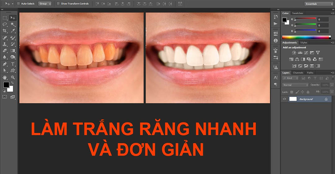 Cách làm trắng răng bằng Adobe Photoshop