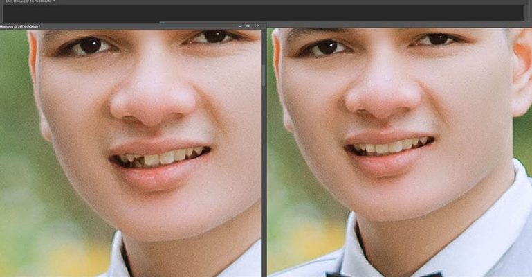 cách photoshop răng đều