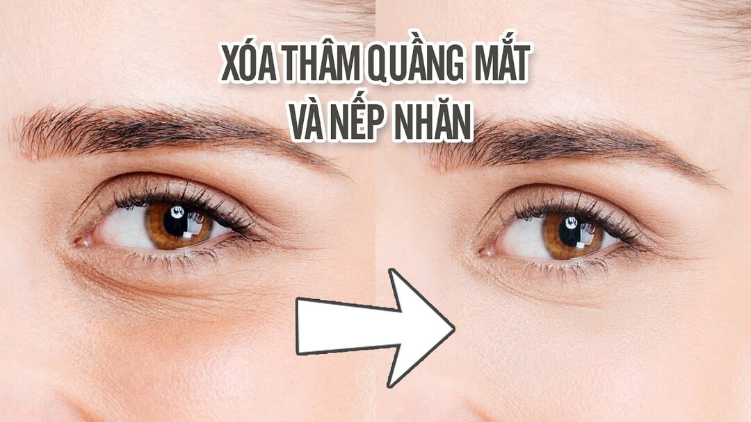 Có thể xóa nếp nhăn vùng mắt bằng Photoshop không?