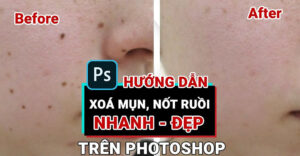 cách xóa nốt ruồi bằng Photoshop