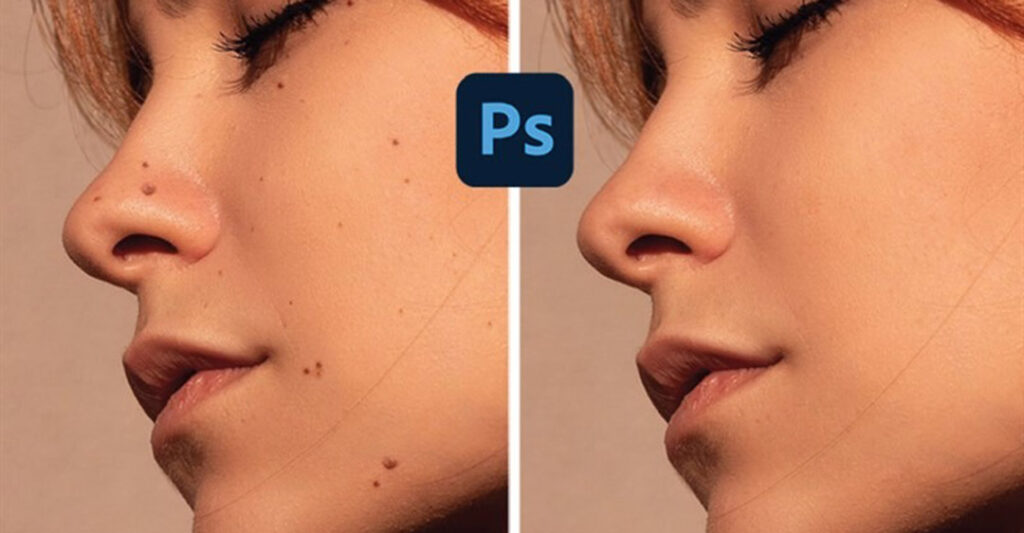 Cách xóa nốt ruồi bằng Photoshop bằng Healing Brush
