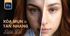 cách xóa tàn nhang trong Photoshop